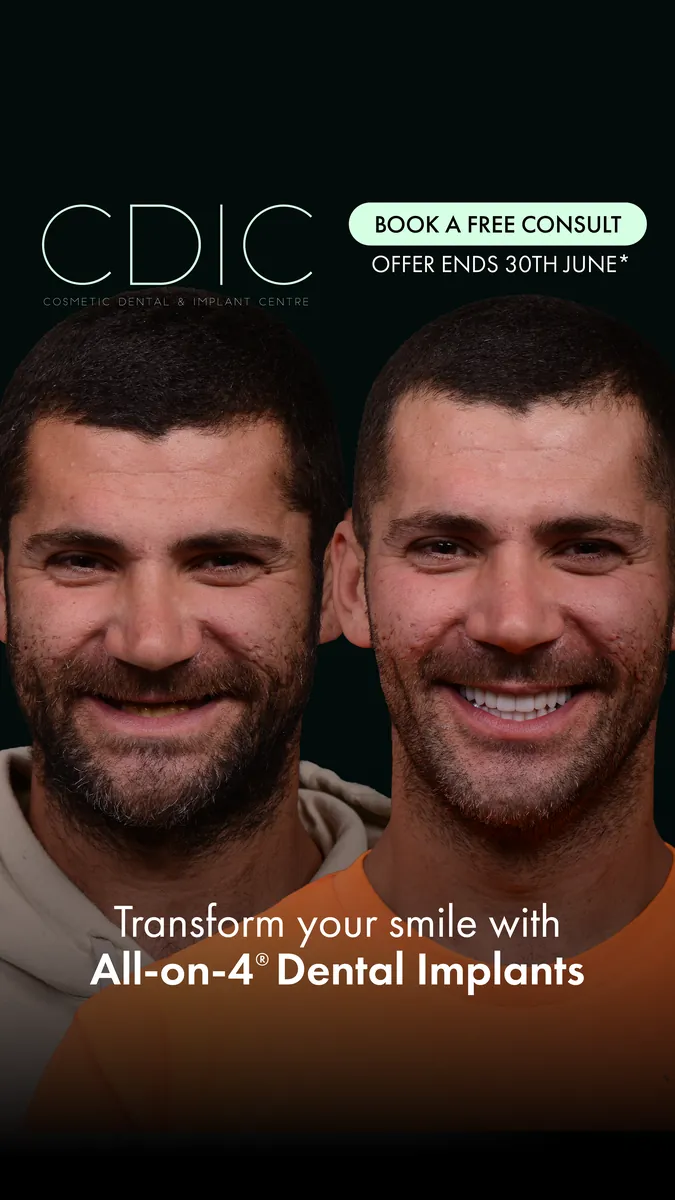 CDIC ad: two smiling men, “Transform your smile with All-on-4 Dental Implants”, book a free consult