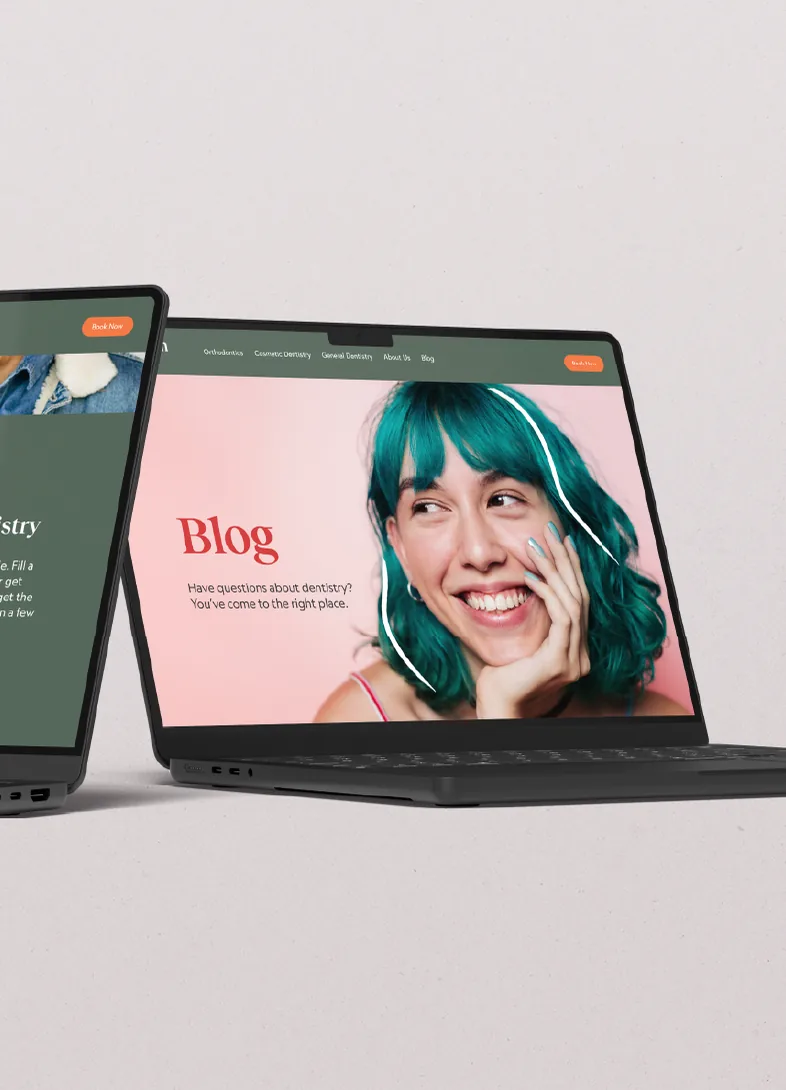 Two laptops showing an Oakleigh Dental website, one open on its Blog page